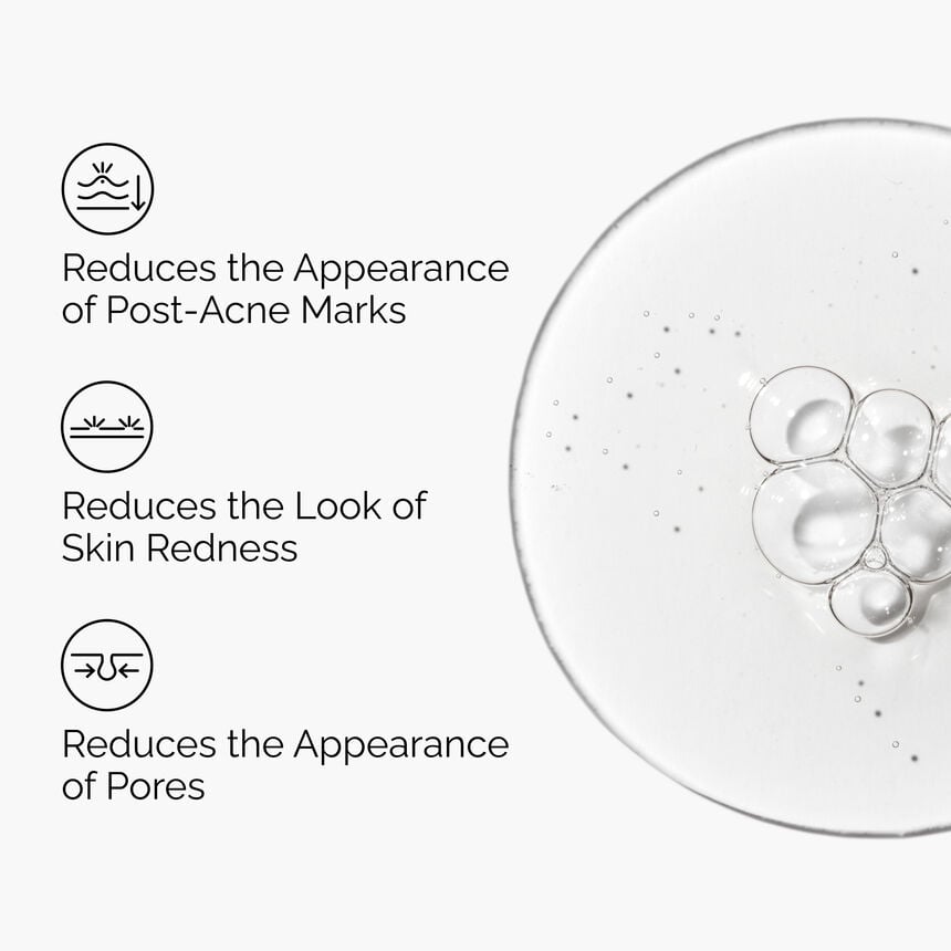 Aloe 2% + NAG 2% Solution Hydrating Skin Barrier Serum - Image 4