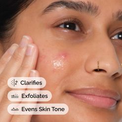 Alternative view of Salicylic Acid 2% Anhydrous Solution Acne Face Treatment