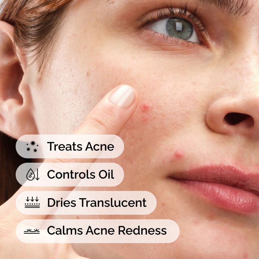 Sulfur 10% Powder-to-Cream Concentrate Acne Treatment - Image 2
