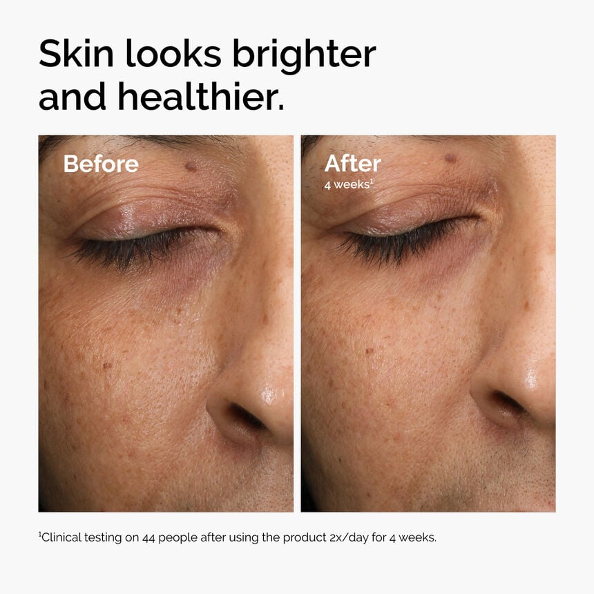 Antioxidant Radiance Serum Brightening Glow Face Serum - Image 4