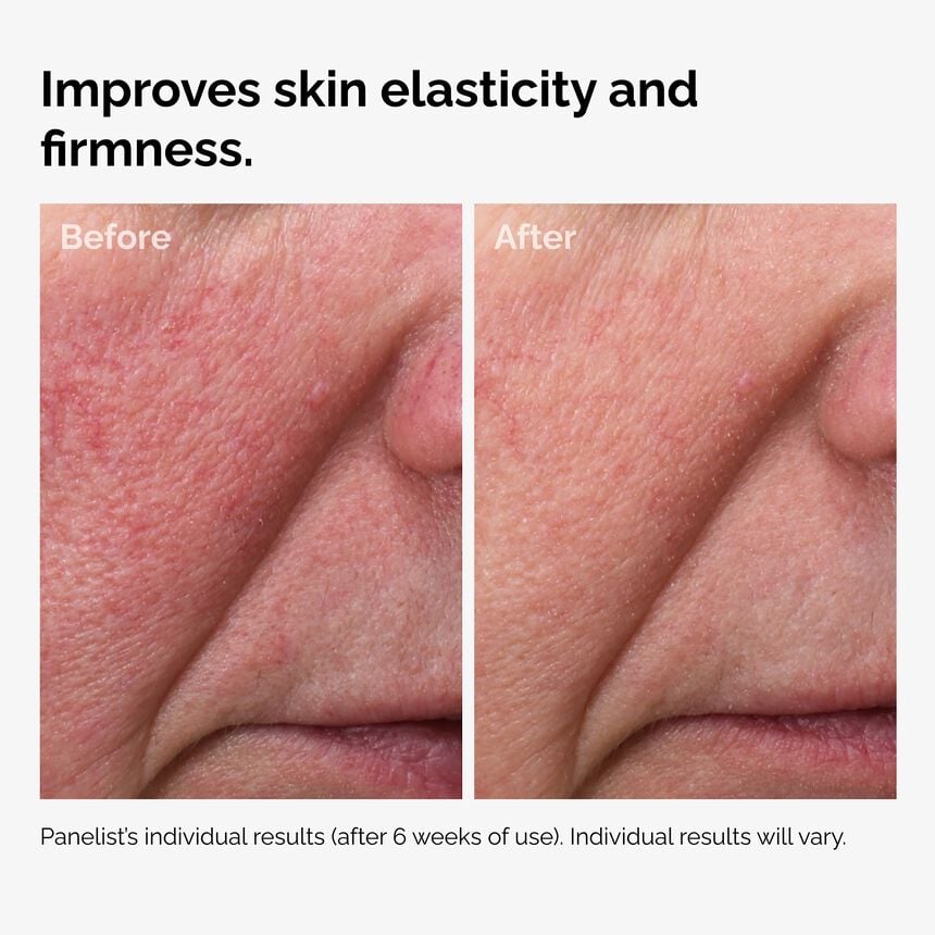 Fermented Rose Hip Seed Oil Face Serum Brightening Skin Care - Image 5