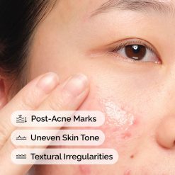 Alternative view of Aloe 2% + NAG 2% Solution Hydrating Skin Barrier Serum