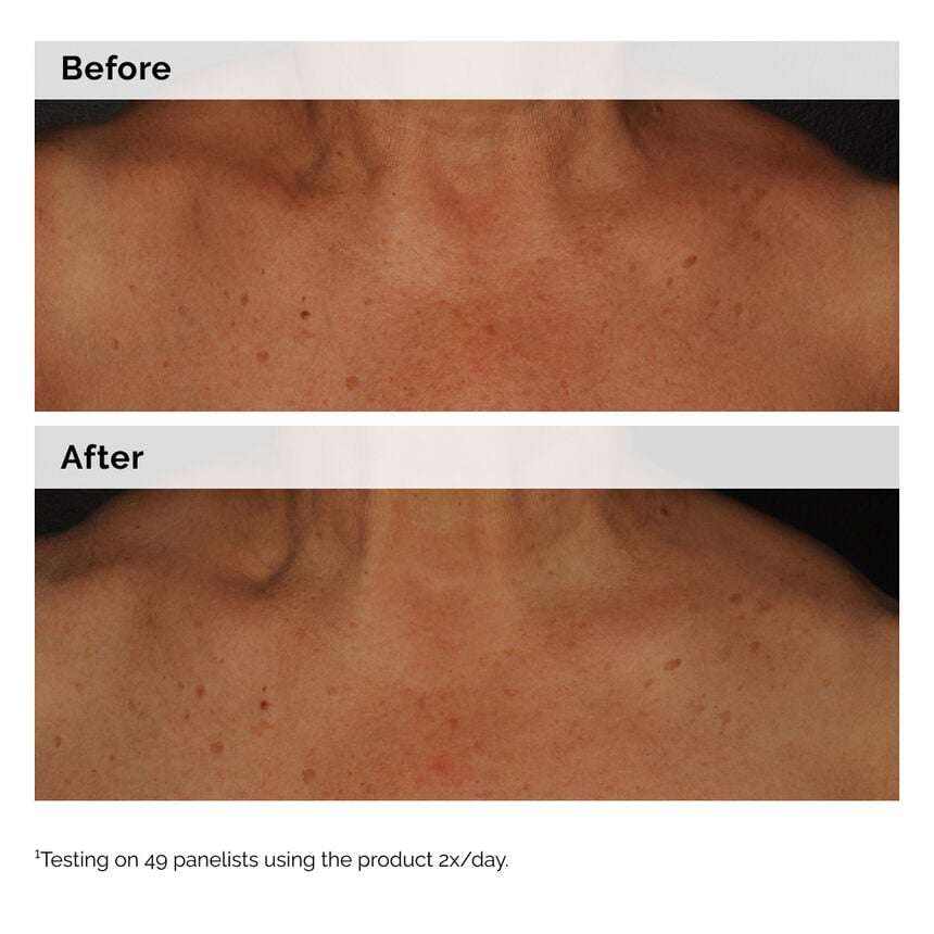 Niacinamide 5% Face and Body Emulsion Hydrating Skin Care - Image 3