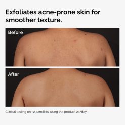 Alternative view of Salicylic Acid 0.5% Body Serum Acne Body Care